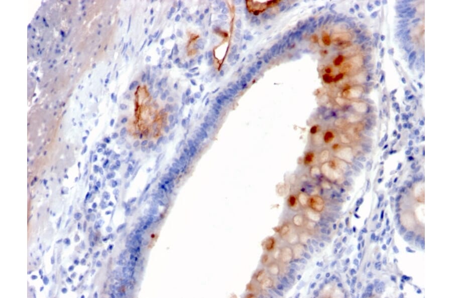 Immunohistochemistry - Anti-MUC4 Antibody [MUC4/3084] (A249428) - Antibodies.com