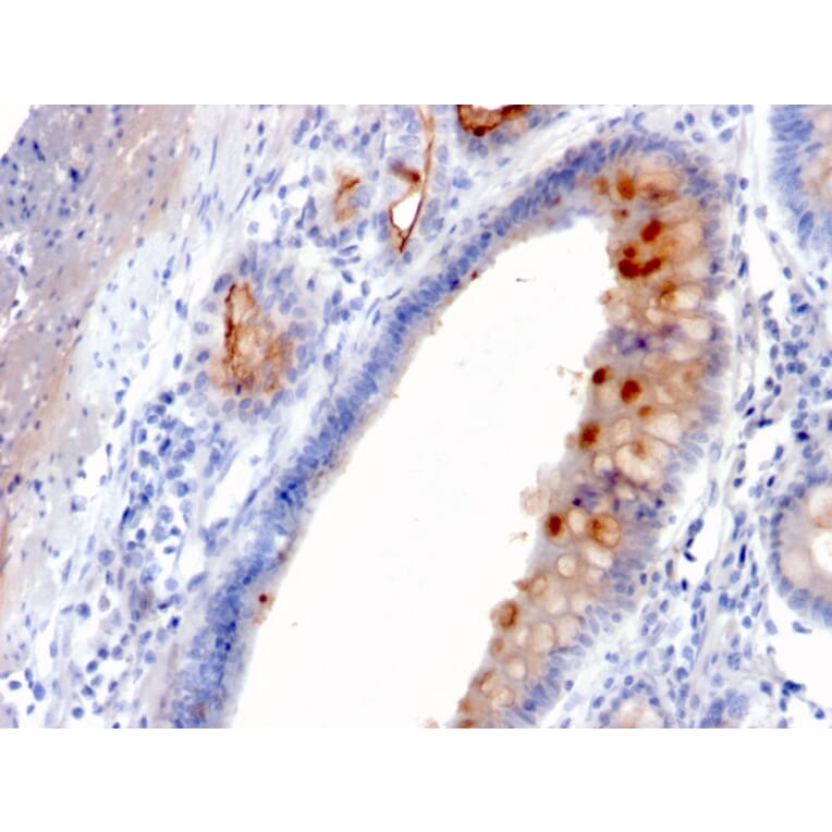 Immunohistochemistry - Anti-MUC4 Antibody [MUC4/3084] (A249428) - Antibodies.com
