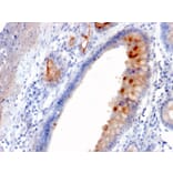 Immunohistochemistry - Anti-MUC4 Antibody [MUC4/3084] (A249428) - Antibodies.com