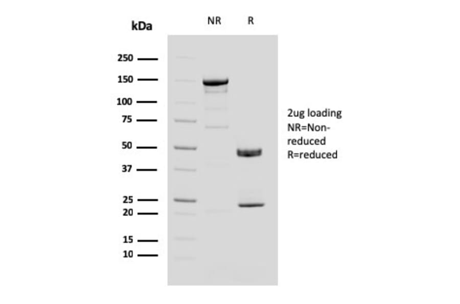 SDS-PAGE - Anti-MUC4 Antibody [MUC4/3084] (A249428) - Antibodies.com