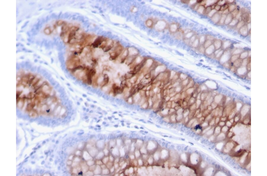 Immunohistochemistry - Anti-MUC4 Antibody [MUC4/3105] (A249429) - Antibodies.com
