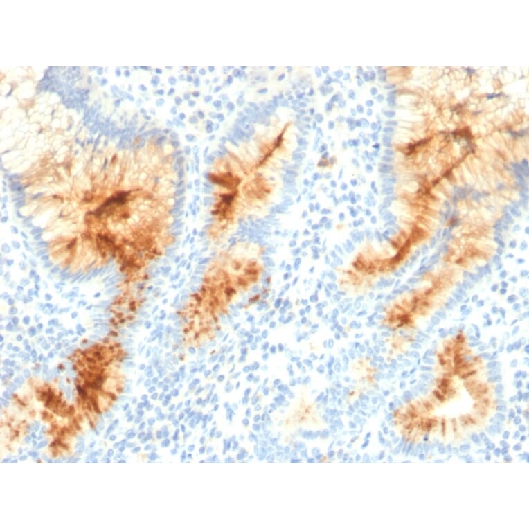 Immunohistochemistry - Anti-MUC4 Antibody [MUC4/3105] (A249429) - Antibodies.com