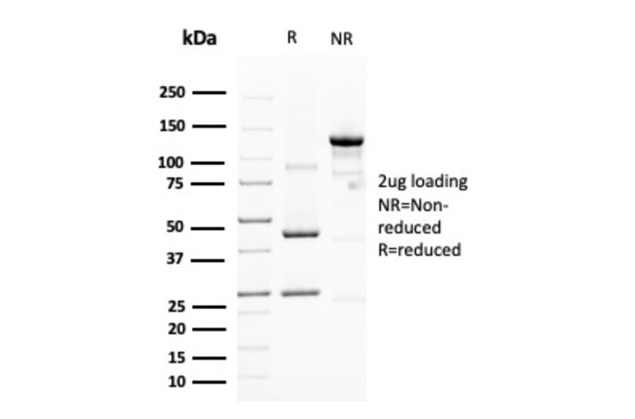 SDS-PAGE - Anti-MUC4 Antibody [MUC4/3105] (A249429) - Antibodies.com