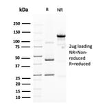 SDS-PAGE - Anti-MUC4 Antibody [MUC4/3105] (A249429) - Antibodies.com