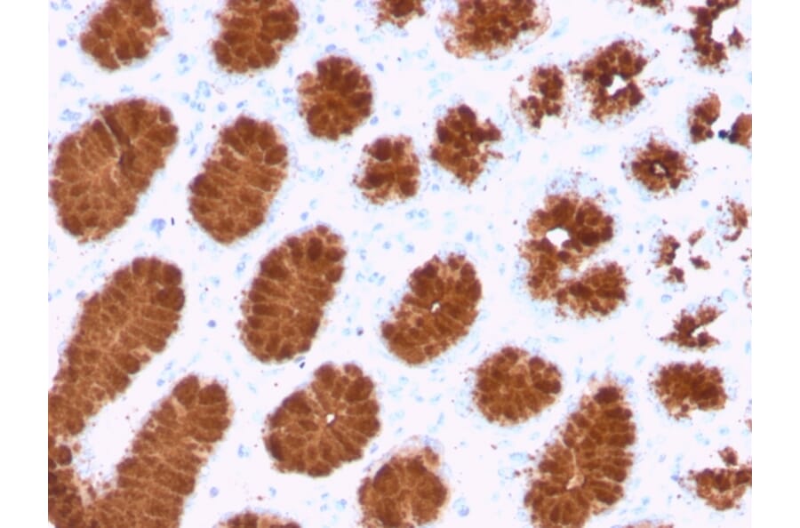 Immunohistochemistry - Anti-Mucin 5AC Antibody [rMUC5AC/3779] (A249429) - Antibodies.com