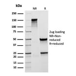 SDS-PAGE - Anti-Mucin 5AC Antibody [rMUC5AC/3779] (A249430) - Antibodies.com
