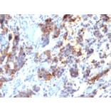 Immunohistochemistry - Anti-Mucin 5AC Antibody [45M1] (A249430) - Antibodies.com