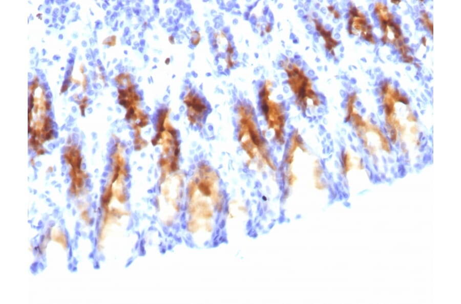 Immunohistochemistry - Anti-Mucin 5AC Antibody [45M1] (A249431) - Antibodies.com