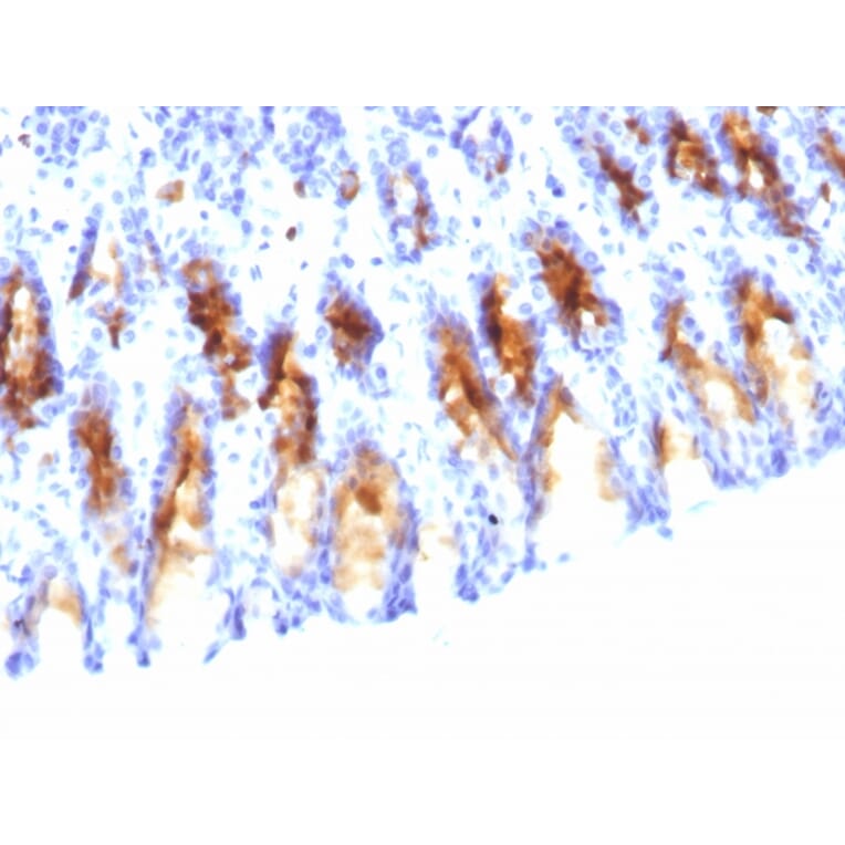 Immunohistochemistry - Anti-Mucin 5AC Antibody [45M1] (A249431) - Antibodies.com