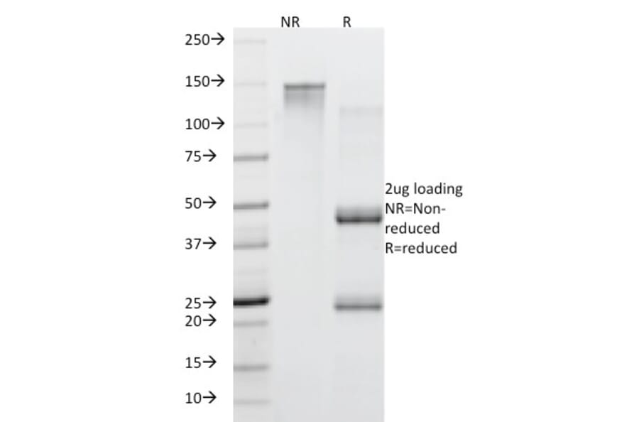 SDS-PAGE - Anti-Mucin 5AC Antibody [45M1] (A249431) - Antibodies.com