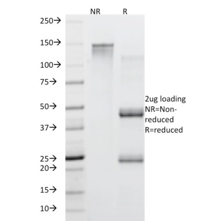 SDS-PAGE - Anti-Mucin 5AC Antibody [45M1] (A249431) - Antibodies.com
