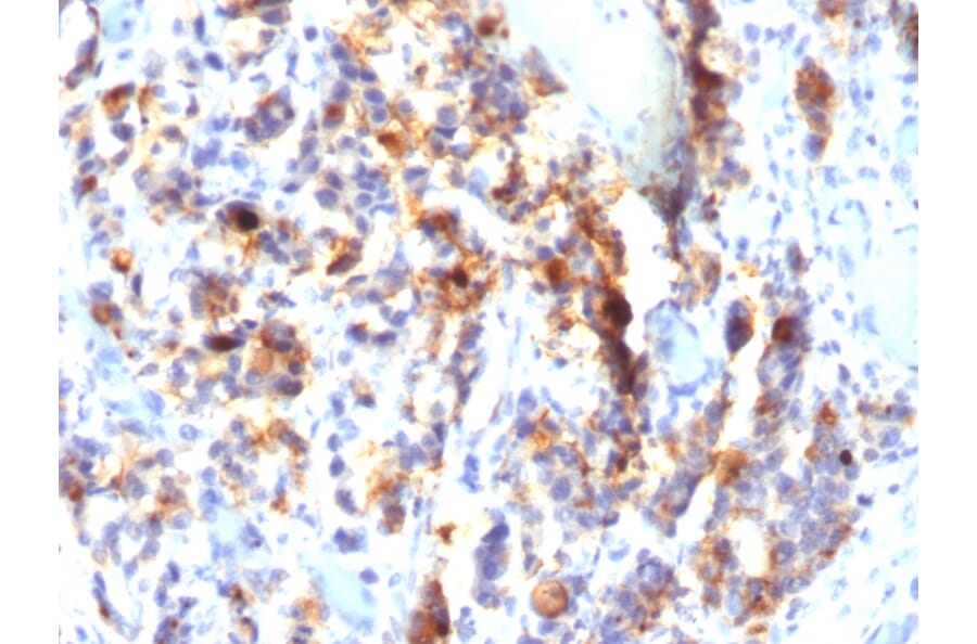 Immunohistochemistry - Anti-Mucin 5AC Antibody [SPM297] (A249431) - Antibodies.com