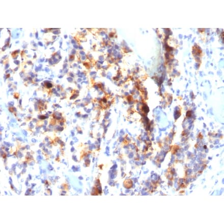 Immunohistochemistry - Anti-Mucin 5AC Antibody [SPM297] (A249431) - Antibodies.com