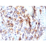 Immunohistochemistry - Anti-Mucin 5AC Antibody [SPM297] (A249431) - Antibodies.com