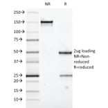 SDS-PAGE - Anti-Mucin 5AC Antibody [58M1] (A249432) - Antibodies.com
