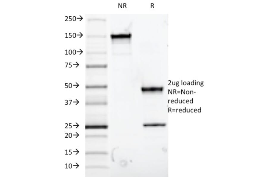SDS-PAGE - Anti-Mucin 5AC Antibody [9-13M1] (A249434) - Antibodies.com