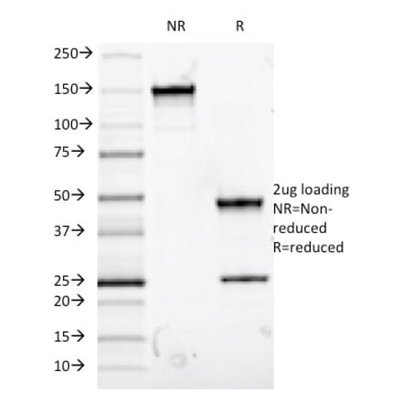 SDS-PAGE - Anti-Mucin 5AC Antibody [9-13M1] (A249434) - Antibodies.com