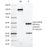 SDS-PAGE - Anti-Mucin 5AC Antibody [9-13M1] (A249434) - Antibodies.com
