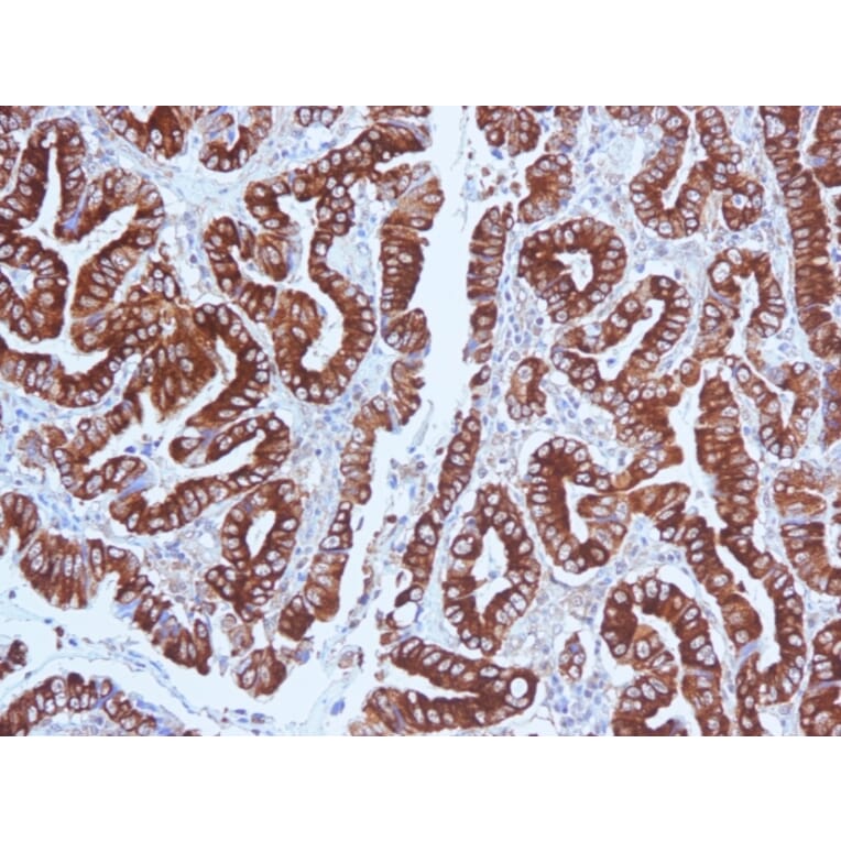 Immunohistochemistry - Anti-Mucin 5AC Antibody [CLH2] (A249435) - Antibodies.com