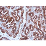 Immunohistochemistry - Anti-Mucin 5AC Antibody [CLH2] (A249435) - Antibodies.com