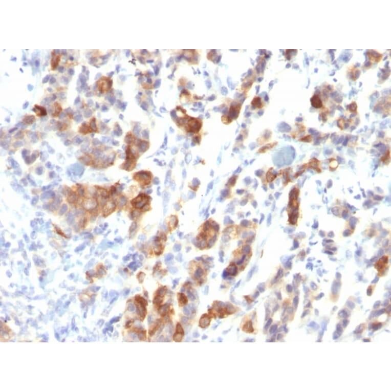 Immunohistochemistry - Anti-Mucin 5AC Antibody [MUC5AC/917] (A249437) - Antibodies.com