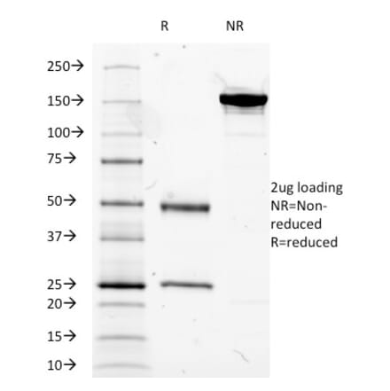 SDS-PAGE - Anti-Mucin 5AC Antibody [2-11M1] (A249438) - Antibodies.com