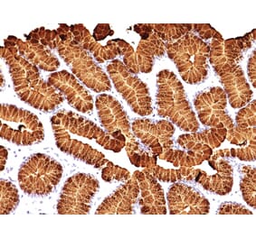 Immunohistochemistry - Anti-Mucin 5AC Antibody [MUC5AC/917 + 45M1] (A249441) - Antibodies.com