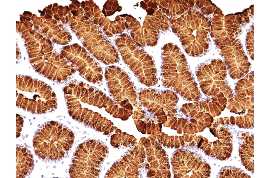 Immunohistochemistry - Anti-Mucin 5AC Antibody [MUC5AC/917 + 45M1] (A249441) - Antibodies.com