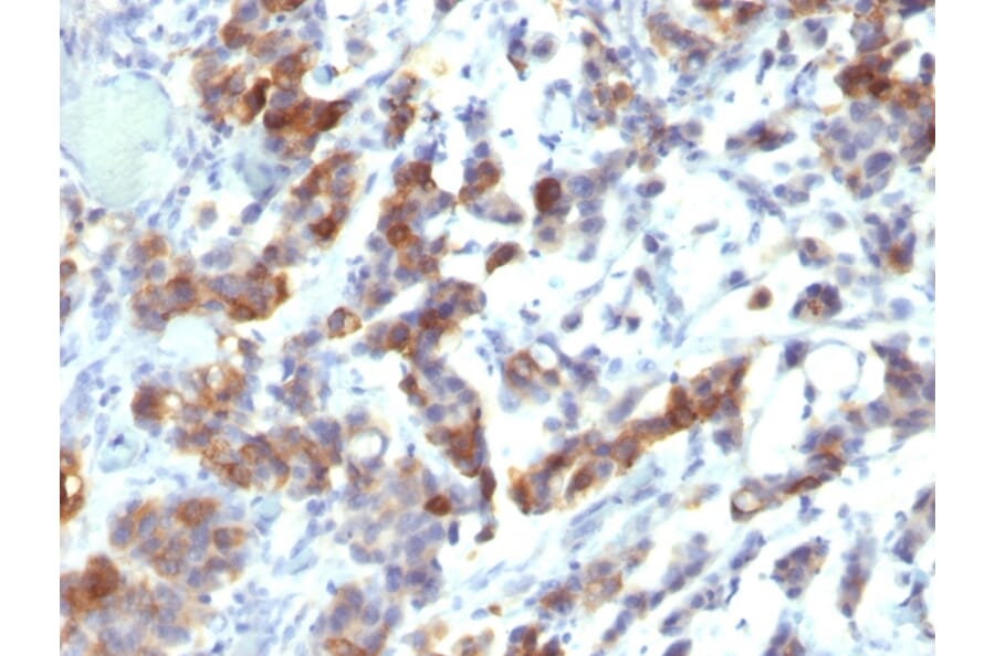 Immunohistochemistry - Anti-Mucin 5AC Antibody [MUC5AC/917 + 45M1] (A249439) - Antibodies.com