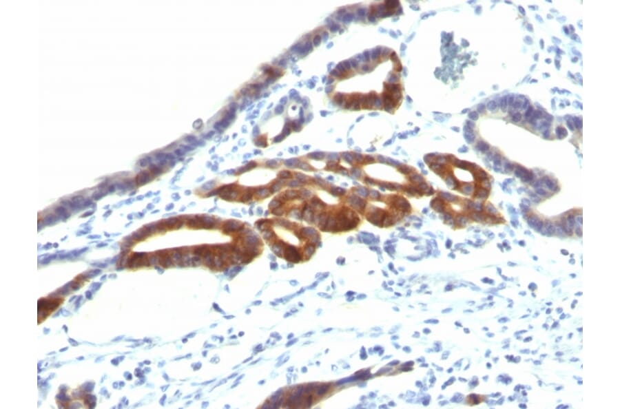 Immunohistochemistry - Anti-MUC6 Antibody [SPM598] (A249442) - Antibodies.com