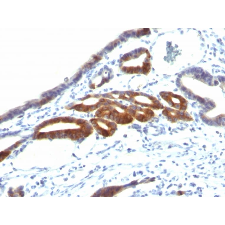 Immunohistochemistry - Anti-MUC6 Antibody [SPM598] (A249442) - Antibodies.com