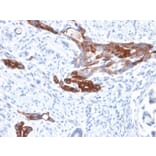 Immunohistochemistry - Anti-MUC6 Antibody [MUC6/1553R] (A249444) - Antibodies.com