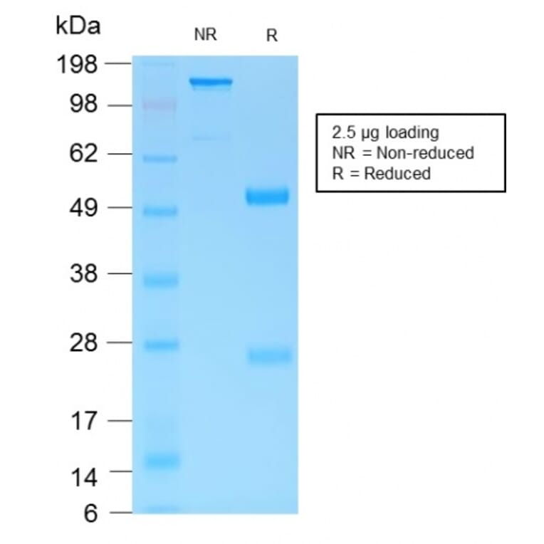 SDS-PAGE - Anti-MUC6 Antibody [MUC6/1553R] (A249445) - Antibodies.com