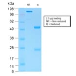 SDS-PAGE - Anti-MUC6 Antibody [MUC6/1553R] (A249445) - Antibodies.com