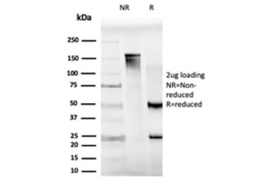 SDS-PAGE - Anti-MXI1 Antibody [PCRP-MXI1-1A3] (A249446) - Antibodies.com