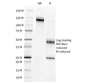 SDS-PAGE - Anti-c-Myb Antibody [MYB286] (A249446) - Antibodies.com