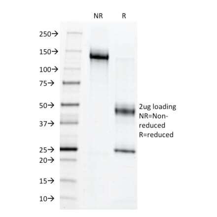 SDS-PAGE - Anti-c-Myb Antibody [MYB286] (A249446) - Antibodies.com