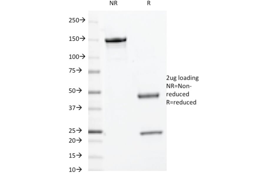 SDS-PAGE - Anti-c-Myc Antibody [9E10.3] (A249451) - Antibodies.com
