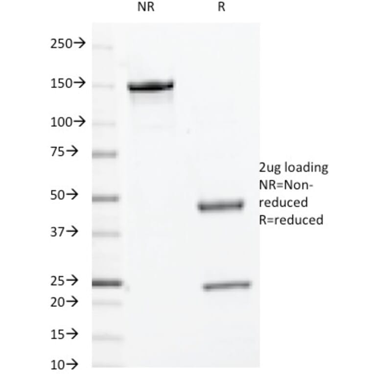 SDS-PAGE - Anti-c-Myc Antibody [9E10.3] (A249451) - Antibodies.com