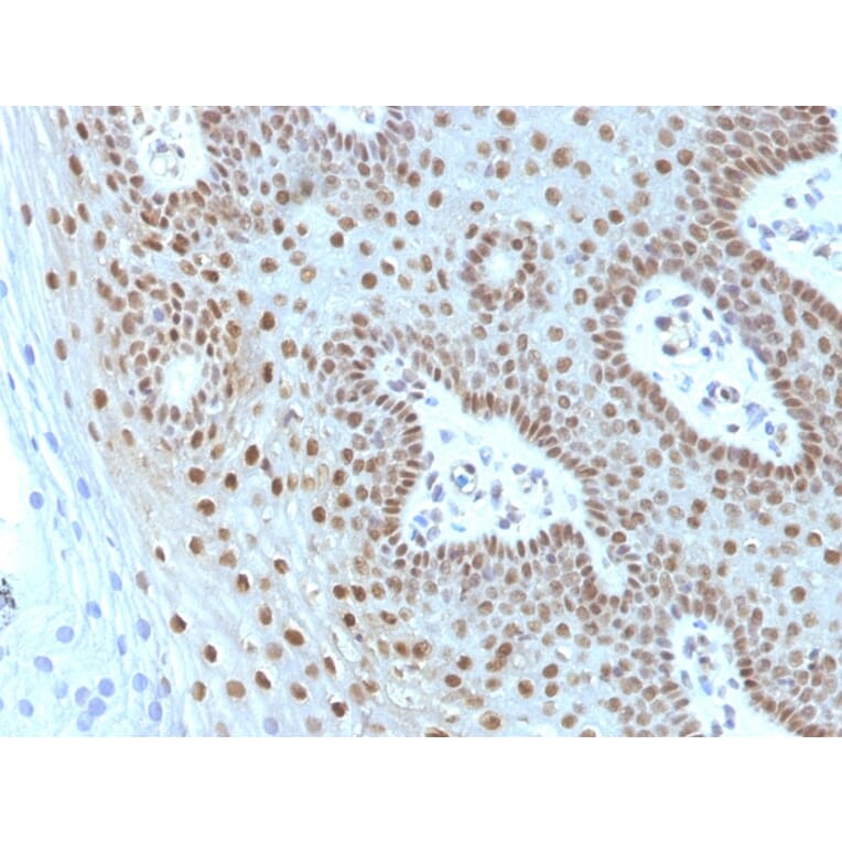 Immunohistochemistry - Anti-c-Myc Antibody [MYC275 + MYC909] (A249453) - Antibodies.com