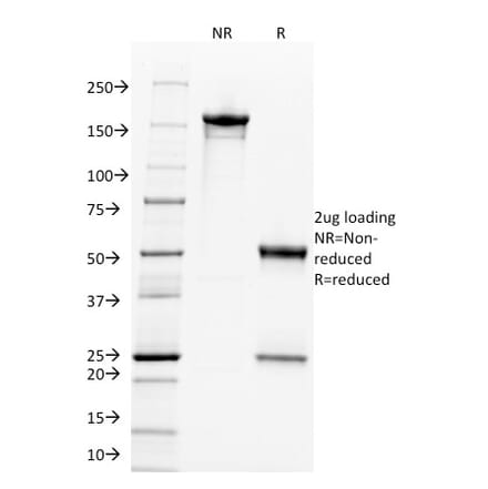 SDS-PAGE - Anti-c-Myc Antibody [9E11] (A249454) - Antibodies.com