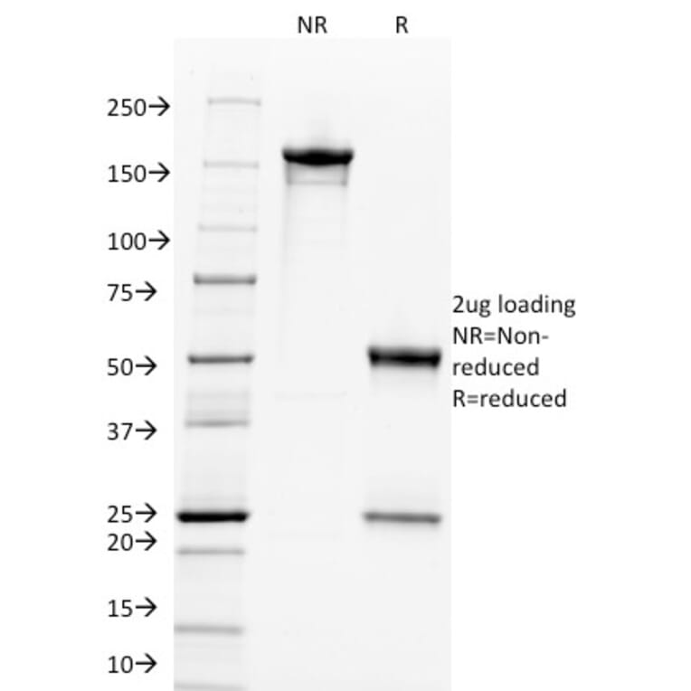 SDS-PAGE - Anti-c-Myc Antibody [9E11] (A249454) - Antibodies.com