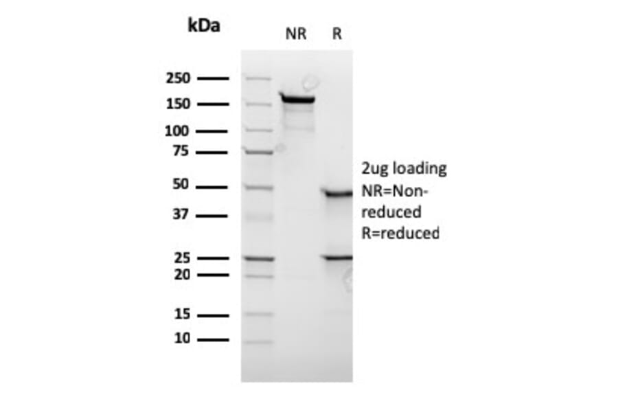 SDS-PAGE - Anti-c-Myc Antibody [rMYC909] (A249456) - Antibodies.com