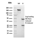 SDS-PAGE - Anti-c-Myc Antibody [rMYC909] (A249456) - Antibodies.com