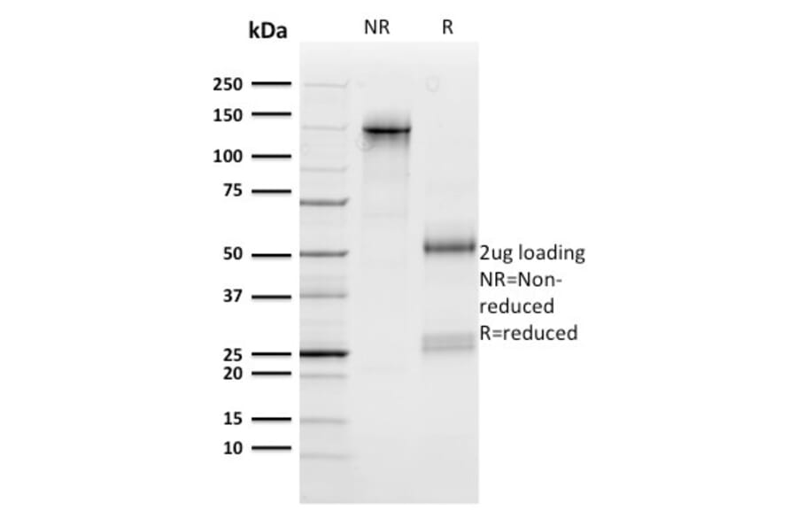SDS-PAGE - Anti-n-Myc Antibody [NMYC-1] (A249457) - Antibodies.com
