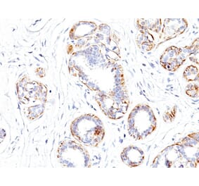 Immunohistochemistry - Anti-MYH11 Antibody [SMMS-1] (A249458) - Antibodies.com