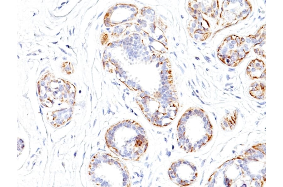 Immunohistochemistry - Anti-MYH11 Antibody [SMMS-1] (A249458) - Antibodies.com