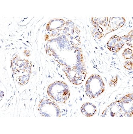 Immunohistochemistry - Anti-MYH11 Antibody [SMMS-1] (A249458) - Antibodies.com