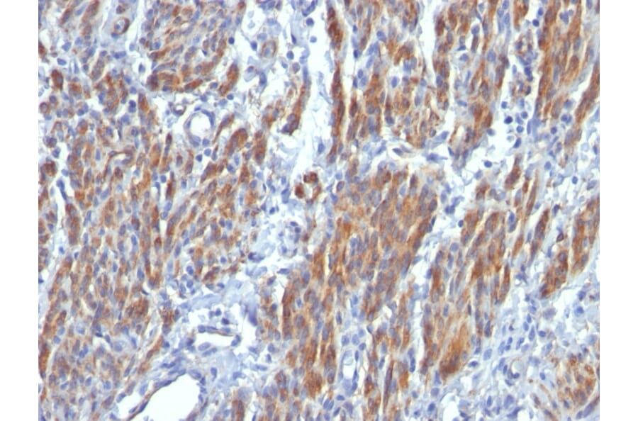 Immunohistochemistry - Anti-MYH11 Antibody [SMMS-1] (A249459) - Antibodies.com