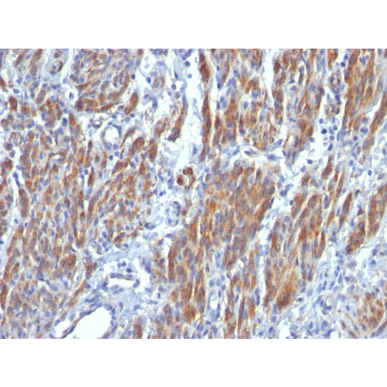 Immunohistochemistry - Anti-MYH11 Antibody [SMMS-1] (A249459) - Antibodies.com